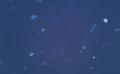 Cell culture precipitates