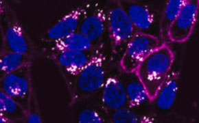 成像分析与活细胞成像