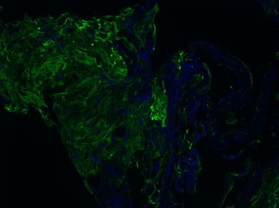 Purified antibodies improve the accuracy of spatial biology research by delivering dependable data on cellular interactions within tissues.