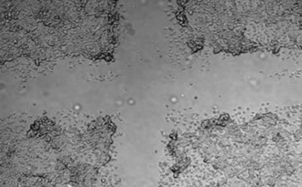 Grayscale, highlighting the differences in cell density and morphology.