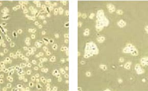 图片展示了细胞的显微对比图，左侧切片显示了密集的、形状不规则的小细胞群，右侧切片显示了较大的、更清晰的、分布较稀疏的细胞。