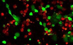 活细胞/死细胞双重染色