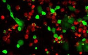 Cell Health Analysis