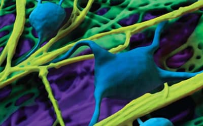 图片展示了一个充满蓝色细胞和黄色纤维结构的显微镜视图，所有这些都以紫色为背景。