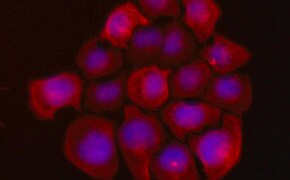 UFH-001 人类乳腺癌细胞的荧光染色