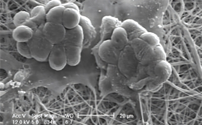 Scanning electron microscope image showing two clusters of round, bulbous structures resembling microbial colonies, adhered to a fibrous matrix. The image is in black and white, emphasizing the texture and detail of the microorganisms and fibers, with a scale bar indicating a measurement of 20 micrometers.