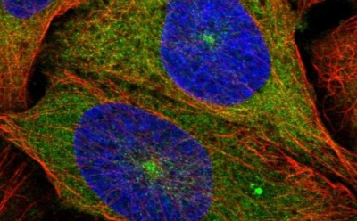 Random HPLC columns on a green background.