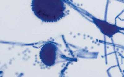 Bacteriology staining micrograph of smear culture using Lactophenol blue
