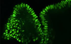 蛋白质质谱工具