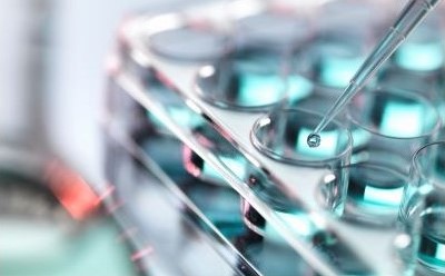 一张多孔板的特写图像，其上多个圆形孔中盛有蓝色液体。图中正使用移液器将液滴转移至其中一个孔中，凸显出实验室环境对精准液体处理与分析的专注。