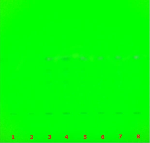 TLC chromatogram for glycyrrhizzic acid under UV 254 nm TLC plate under 254 nm UV showing faint bands across lanes used for glycyrrhizic acid quantification.