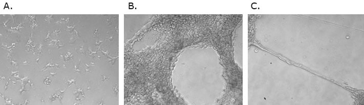 Newrite outgroth Newrite outgroth