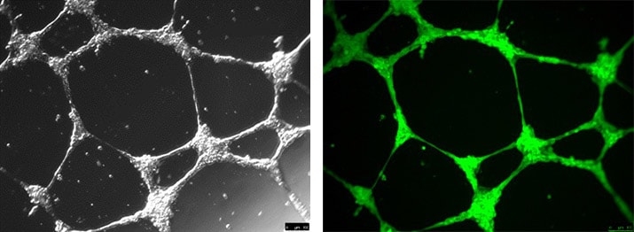 Angiogenesis tube formation using ECM Gel Matrix Angiogenesis tube formation using ECM Gel Matrix
