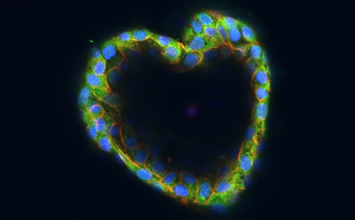 3D organoid culture