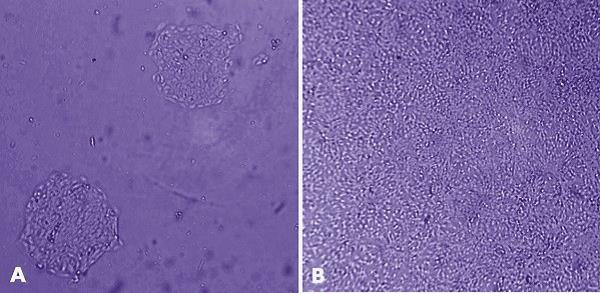 MaxGel™ ECM enables improved expansion of adult keratinocytes.