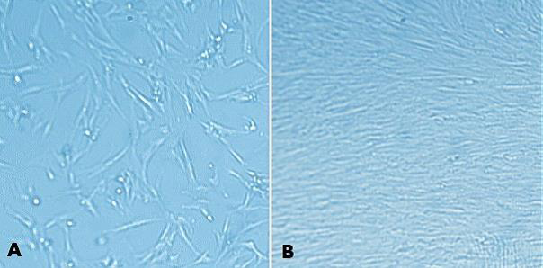 MaxGel™ ECM enables improved expansion of MRC-5 cells.