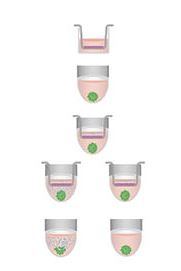 Immune Oncology Model Schematic