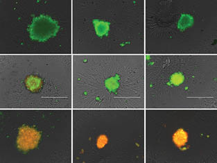 Live (green) and dead (red) stained 96-hour mono- and co-culture A549 and fibroblast spheroids.