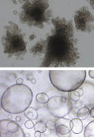 Top image features human rectal organoids from a cystic fibrosis cell source cultured for 10 days in Corning Matrigel matrix. Courtesy of MDI Biological Laboratory. Bottom image features Human liver organoids in Corning Matrigel matrix (perm. L.A. Oosterhoff).