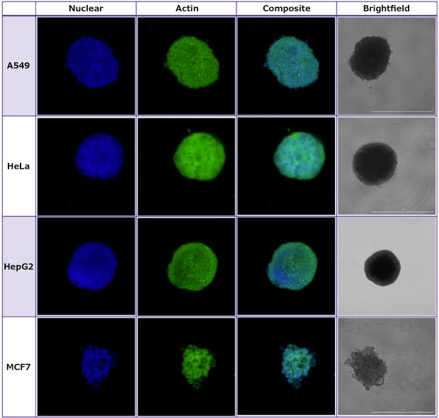 Spheroids formed in Millicell® Ultra-low attachment plates were imaged using brightfield and confocal imaging.