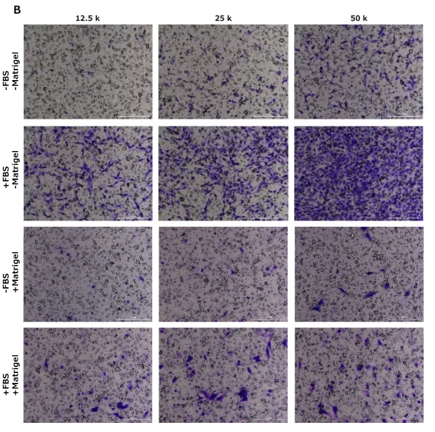 Cell migration assay, crystal violet staining, HT1080, NIH 3T3, MCF-7