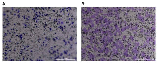 Crystal violet staining of Millicell® inserts