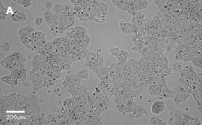 millicell-cell-lines-01042712-a Brightfield imaging of Huh-7D12 cells on Millicell<sup>®</sup> DCI Digital Cell Imager at 10X magnification