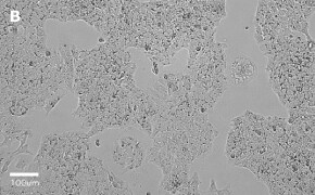 millicell-cell-lines-01042712-b Brightfield imaging of Huh-7D12 cells on Millicell<sup>®</sup> DCI Digital Cell Imager at 20X magnification