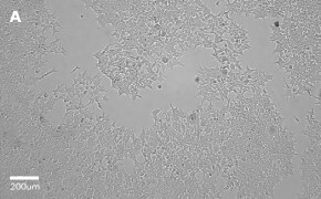 millicell-cell-lines-12022001-a Brightfield imaging of HEK 293T cells on Millicell<sup>®</sup> DCI Digital Cell Imager at 10X magnification