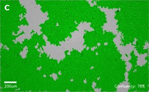 millicell-cell-lines-12022001-c Brightfield imaging of HEK 293T cells on Millicell<sup>®</sup> DCI Digital Cell Imager at 10X magnification with mask