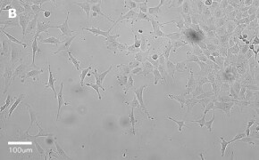 millicell-cell-lines-84100401-b Brightfield imaging of MRC-5 SV2 cells on Millicell<sup>®</sup> DCI Digital Cell Imager at 20X magnification