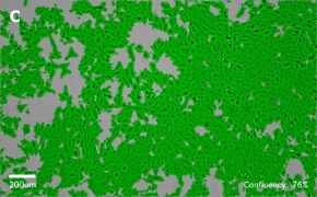 millicell-cell-lines-84100401-c Brightfield imaging of MRC-5 SV2 cells on Millicell<sup>®</sup> DCI Digital Cell Imager at 10X magnification with mask