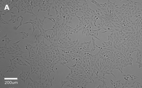Brightfield imaging of Vero cells on Millicell<sup>®</sup> DCI Digital Cell Imager at 10X magnification