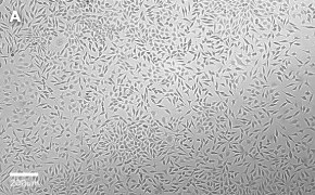 Brightfield imaging of L929 cells on Millicell<sup>®</sup> DCI Digital Cell Imager at 10X magnification