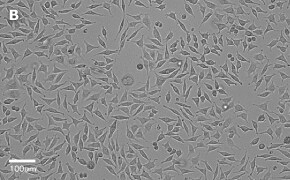 Brightfield imaging of L929 cells on Millicell<sup>®</sup> DCI Digital Cell Imager at 20X magnification