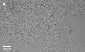 Brightfield imaging of C1008 cells on Millicell<sup>®</sup> DCI Digital Cell Imager at 10X magnification