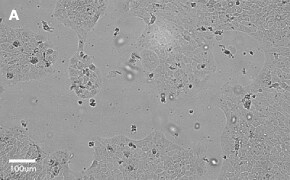millicell-cell-lines-85090402-a Brightfield imaging of A431 cells on Millicell<sup>®</sup> DCI Digital Cell Imager at 10X magnification