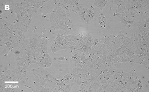 millicell-cell-lines-85090402-b Brightfield imaging of A431 cells on Millicell<sup>®</sup> DCI Digital Cell Imager at 20X magnification