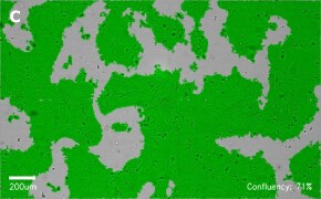 millicell-cell-lines-85090402-c Brightfield imaging of A431 cells on Millicell<sup>®</sup> DCI Digital Cell Imager at 10X magnification with mask