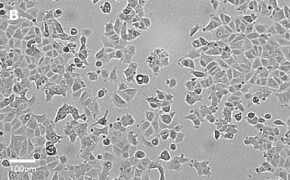 millicell-cell-lines-86012803-b Brightfield imaging of MCF-7 cells on Millicell<sup>®</sup> DCI Digital Cell Imager at 20X magnification