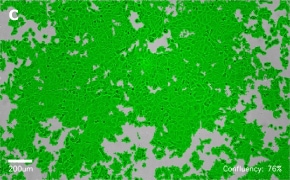 millicell-cell-lines-86012803-c Brightfield imaging of MCF-7 cells on Millicell<sup>®</sup> DCI Digital Cell Imager at 10X magnification with mask