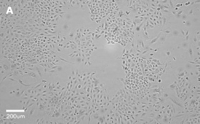 millicell-cell-lines-86012804-a Brightfield imaging of A549 cells on Millicell<sup>®</sup> DCI Digital Cell Imager at 10X magnification