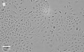 millicell-cell-lines-86012804-b Brightfield imaging of A459 cells on Millicell<sup>®</sup> DCI Digital Cell Imager at 20X magnification