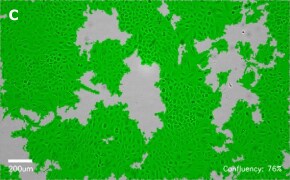 millicell-cell-lines-86012804-c Brightfield imaging of A459 cells on Millicell<sup>®</sup> DCI Digital Cell Imager at 10X magnification with mask