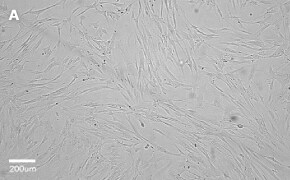 millicell-cell-lines-90020107-a Brightfield imaging of WI38 cells on Millicell<sup>®</sup> DCI Digital Cell Imager at 10X magnification