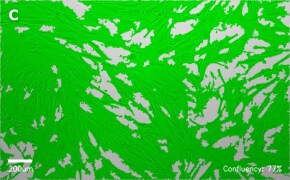 millicell-cell-lines-90020107-c Brightfield imaging of WI38 cells on Millicell<sup>®</sup> DCI Digital Cell Imager at 10X magnification with mask