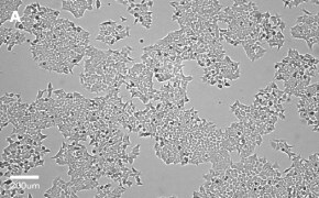 millicell-cell-lines-91091005-a Brightfield imaging of HCT116 cells on Millicell<sup>®</sup> DCI Digital Cell Imager at 10X magnification