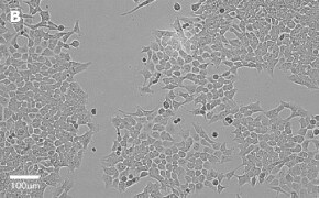 millicell-cell-lines-91091005-b Brightfield imaging of HCT116 cells on Millicell<sup>®</sup> DCI Digital Cell Imager at 20X magnification