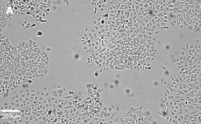 millicell-cell-lines-93021013-a Brightfield imaging of HeLa cells on Millicell<sup>®</sup> DCI Digital Cell Imager at 10X magnification