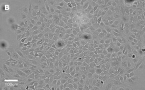 millicell-cell-lines-93021013-b Brightfield imaging of HeLa cells on Millicell<sup>®</sup> DCI Digital Cell Imager at 20X magnification
